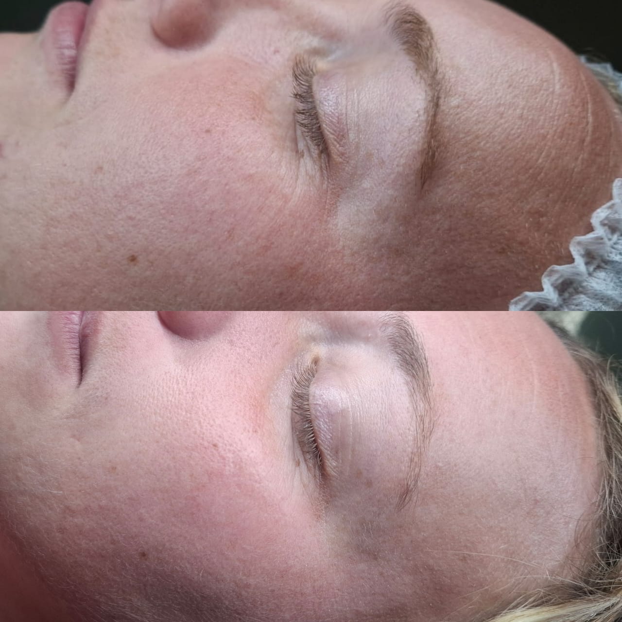 Eyebrow treatment before and after